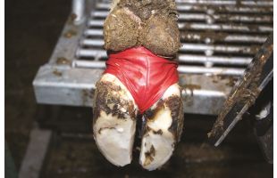 Bandage " chaussette "